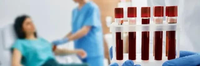 Why Gym Goers Taking Creatine Should Do a KFT Test